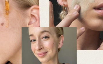 My Clear Skin Journey: Here Are the Exact Steps I Took to Clear My Hormonal Acne